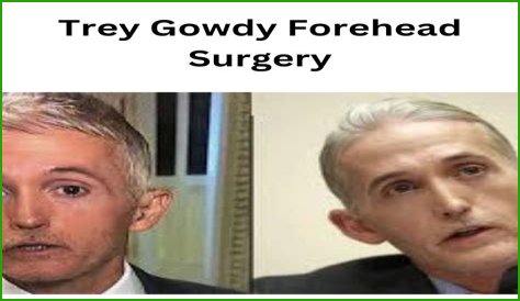 Trey Gowdy: Did He Have Facial Surgery?
